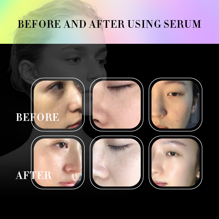 New Product Technologically Advanced Capsule Systems Machine Distributors Skin Clean Beauty Device Beauty Skin Care Center