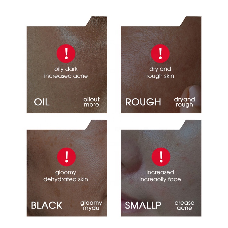 Private Label Men's Skin Care Set Face Wash &amp; Toner Serum Spf 20 Cream Oil Control PM/AM Anti Aging Facial Skincare Kit Product