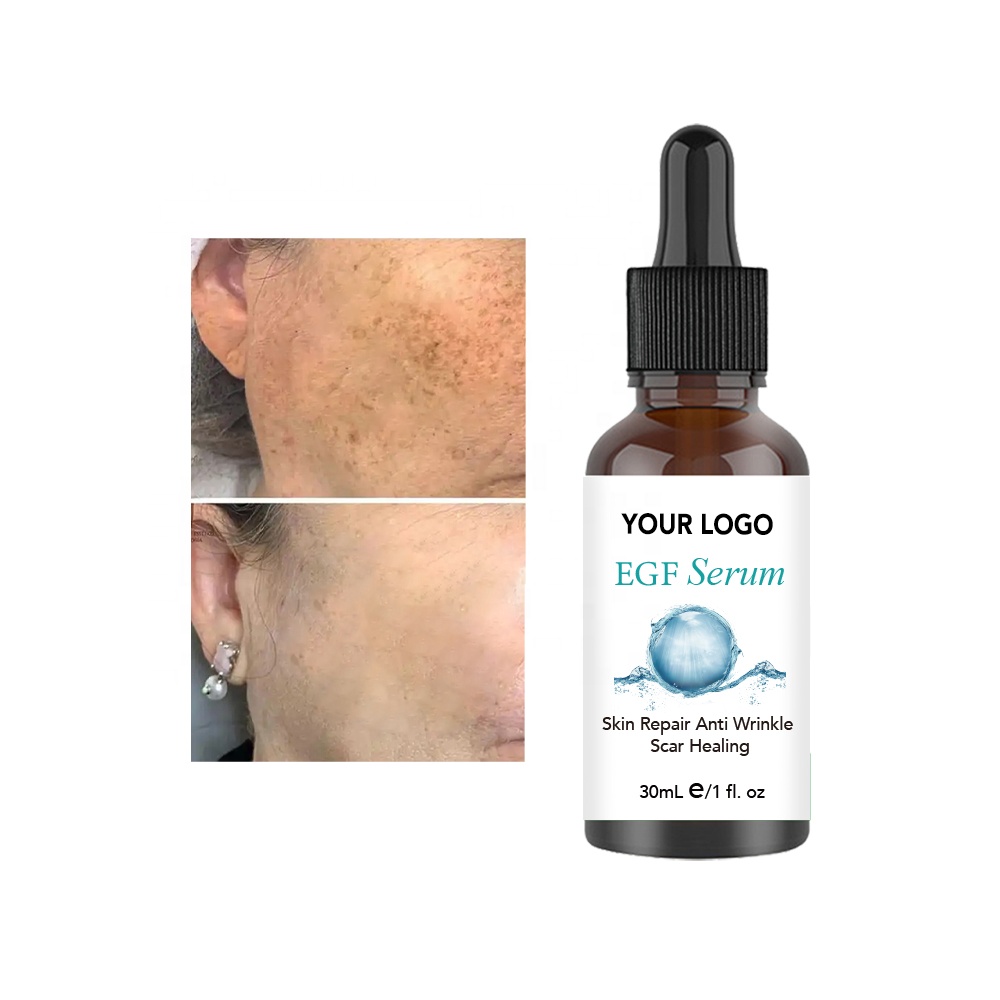 Hot Selling Best Face Serum Vegan Face Serum Private Label Whitening Lightening Egf Face Serum