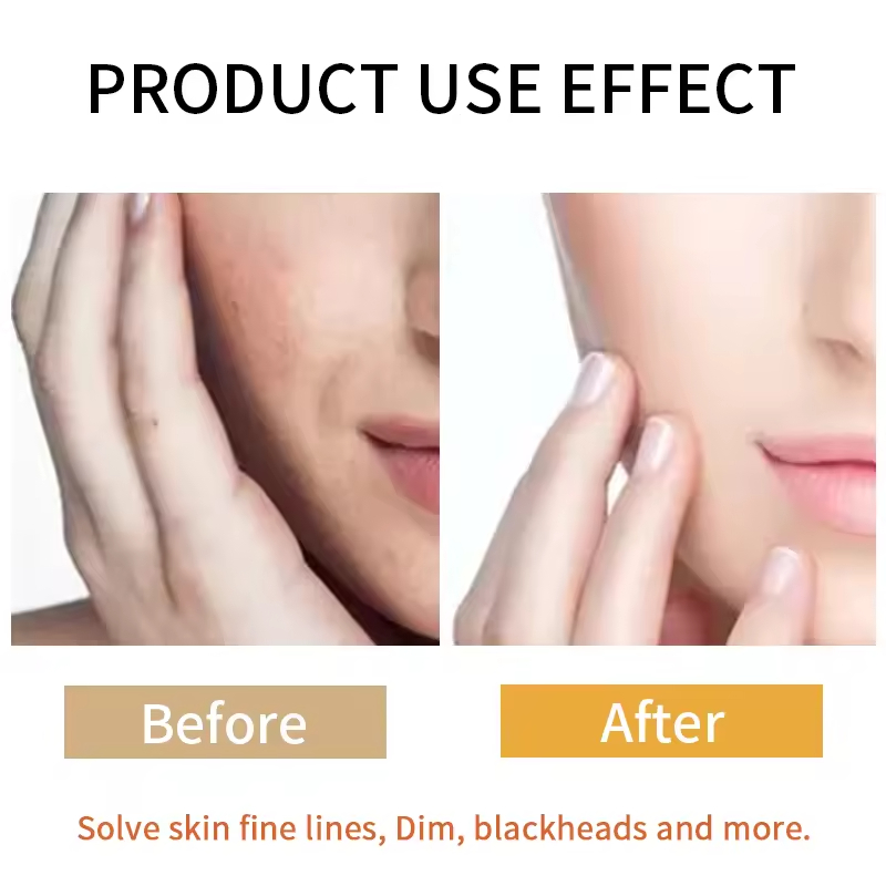 Custom Logo Turmeric Essence Facial Skincare Set Products Brightening Moisturizing Acne Beauty Cosmetics Face Skin Care Kit