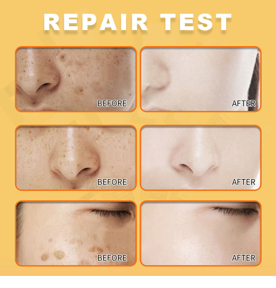 Skincare detail 3