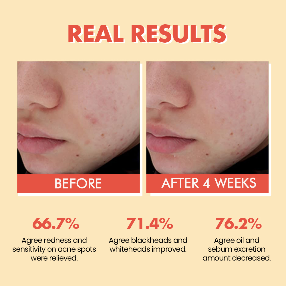 Korea Private Label Organic Anti-Aging Anti-Wrinkle Face Serum Vitamin C Retinal Skincare Repair Oil Natural Skin Care Products