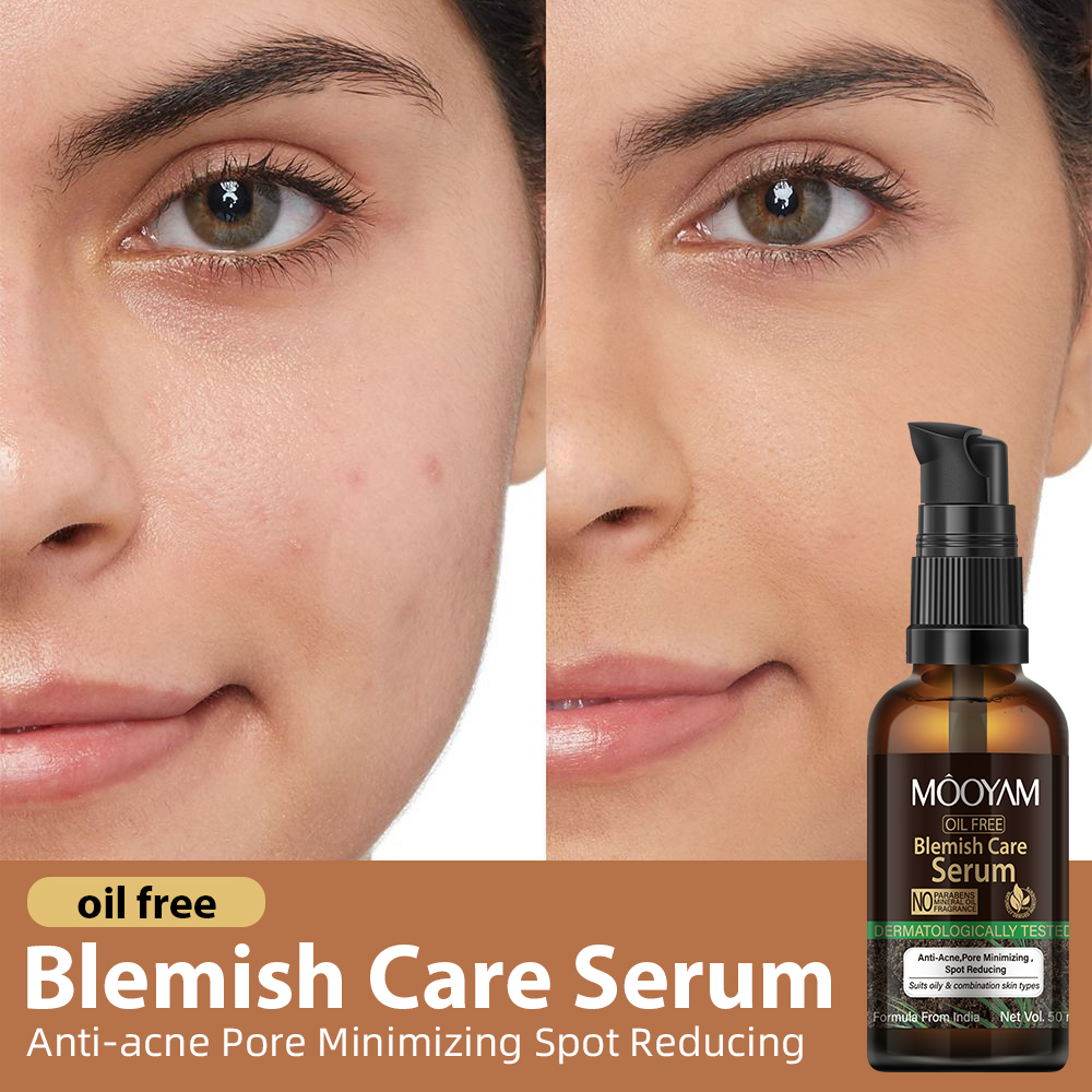 2023 Latest Skin Care OEM Acne Treatment Salicylic Acid Facial Efficient Acne Removal Solution