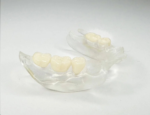 Custom Affordable Clear Pink Removable Partial Valplast Dentures with Flexible Base Acrylic Teeth