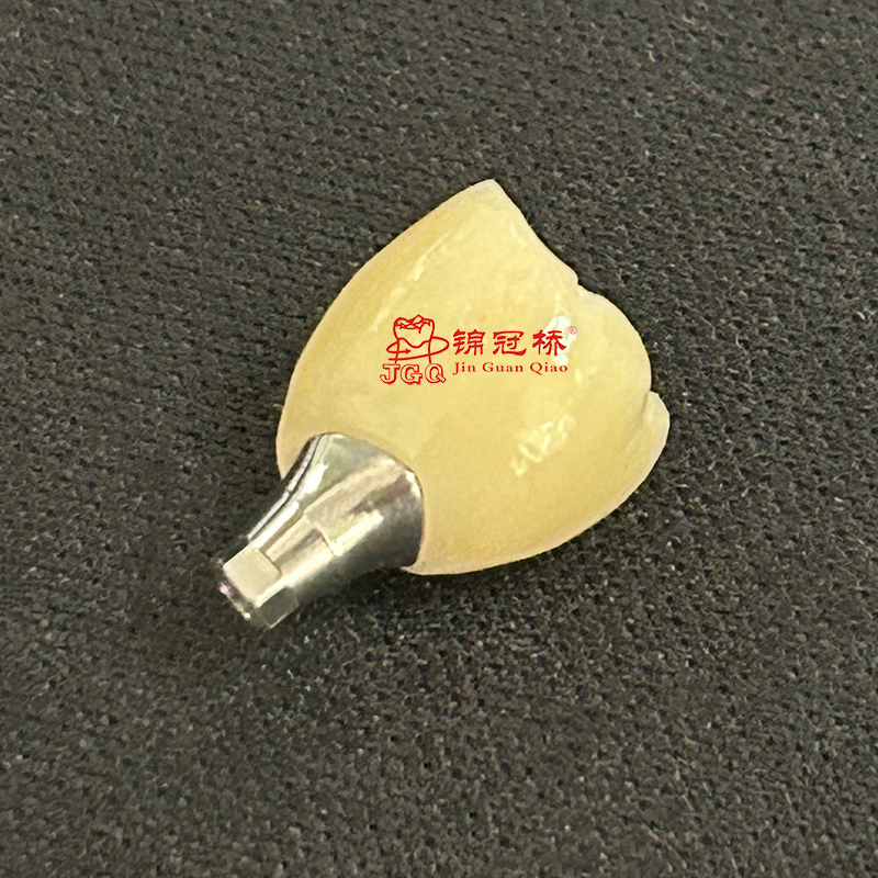 Implanted Dentures Manufacturer Custom Titanium Abutments Precise Adaptation Implants Aesthetically Pleasing Strong and Durable