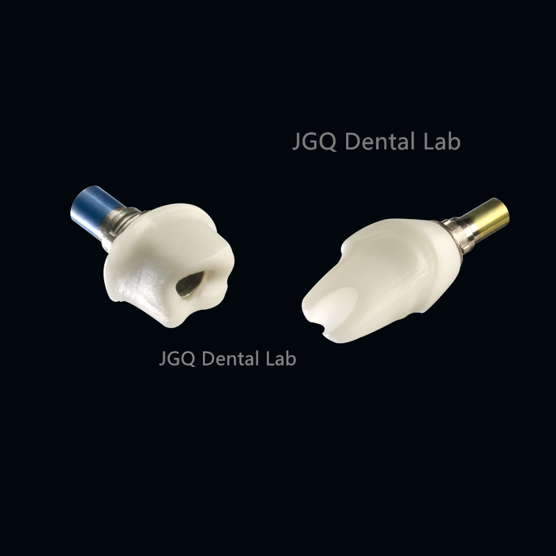 Good Price Affordable Dentures Multi-Unit Abutment Dental Implant System