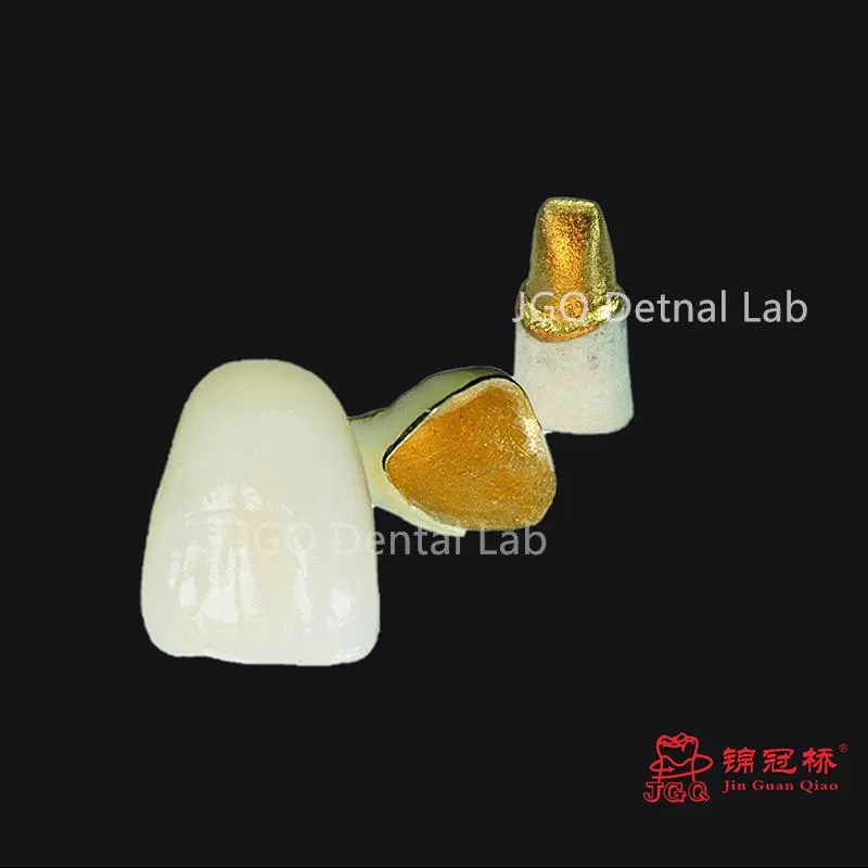 Dental Restoration Product 2