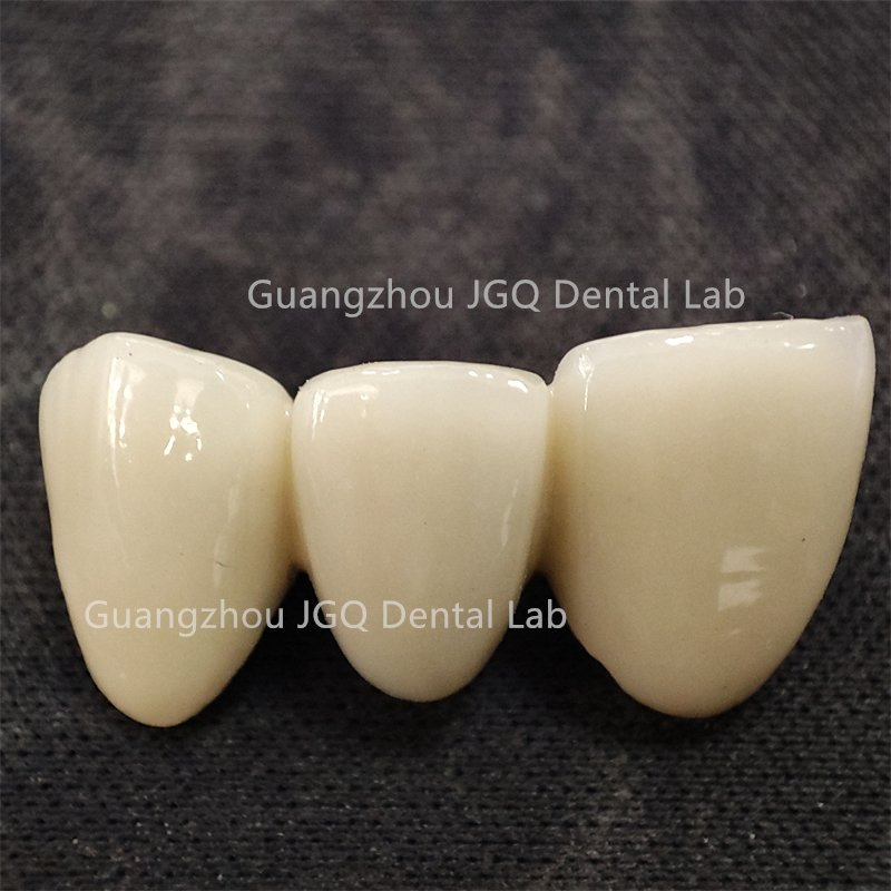 Digital Files Stl Outsoucing Dental Lab Metal Ceramic Pfm Crown Bridges China Price