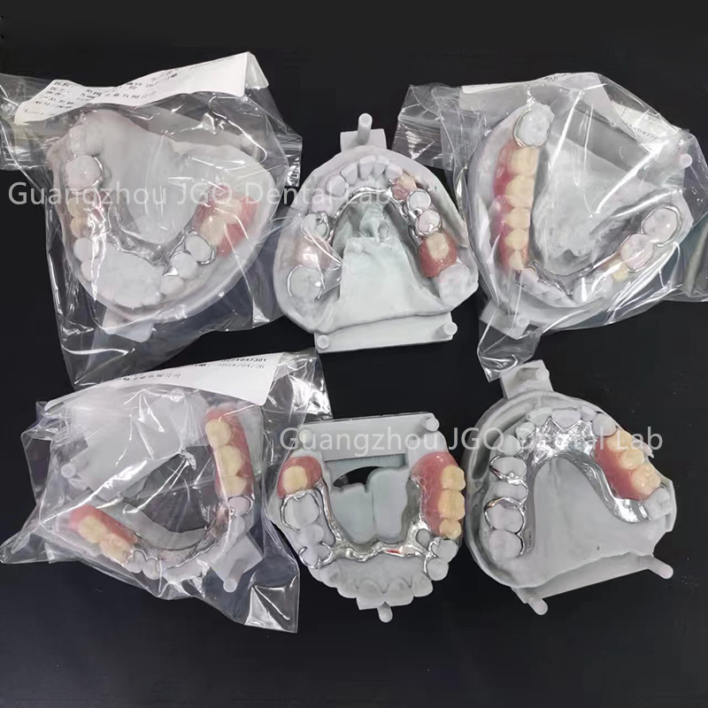 Removable Dentures Manufacturer Customize Partial Metal Frame with Acrylic Teeth Flexible