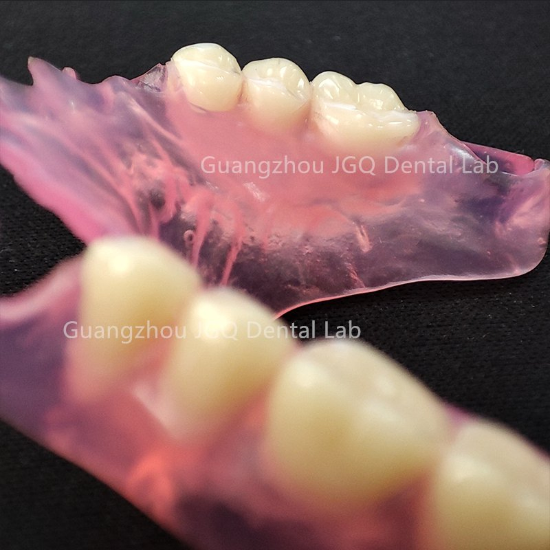 China Dental Lab Valplast Flexible Dentures