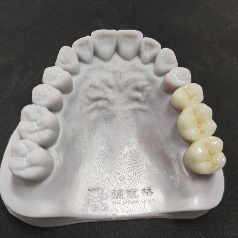 Digital Dental China Custom Full Solid Zirconia Bridge Crown Anterior Posterior Restoration Outsourcing Lab