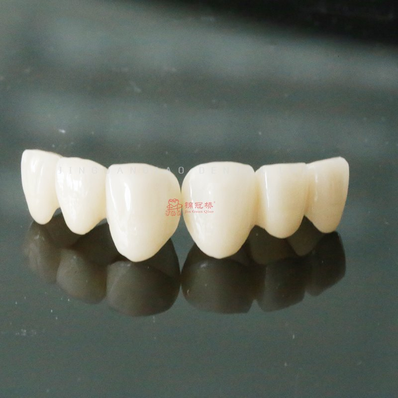 Dental Solid Zirconia Crowns Bridges Fixed Denture Restorations to Improve The Original Tooth
