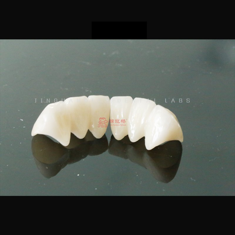 Dental Solid Zirconia Crowns Bridges Fixed Denture Restorations to Improve The Original Tooth