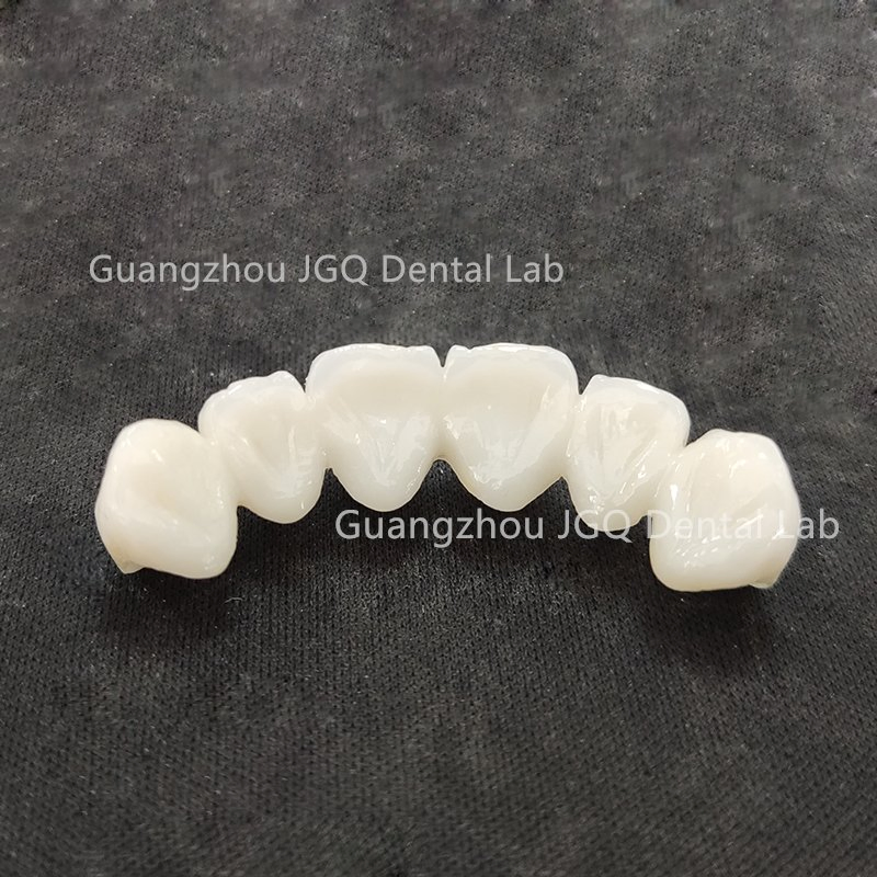 Outsourced Dental Lab Services Custom Zirconia Crown Bridge Anterior Posterior Restoration Best Price