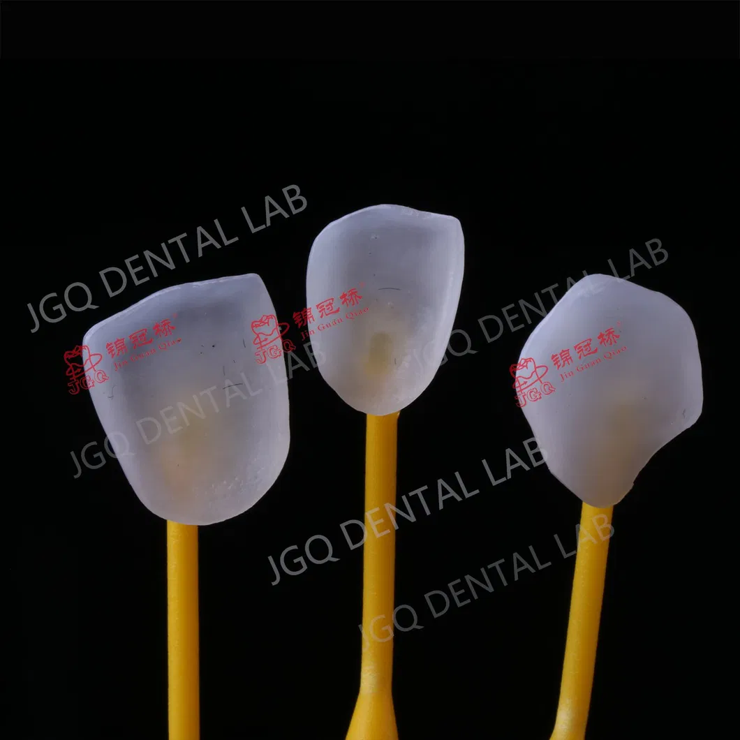 Dental Restoration Product 1