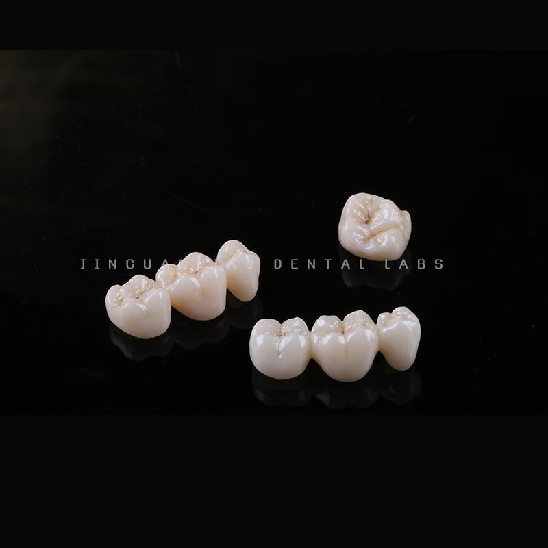 High Quality Perfect Perfect Aesthetic Zirconia Dentures Crown and Bridges with Cheap Price