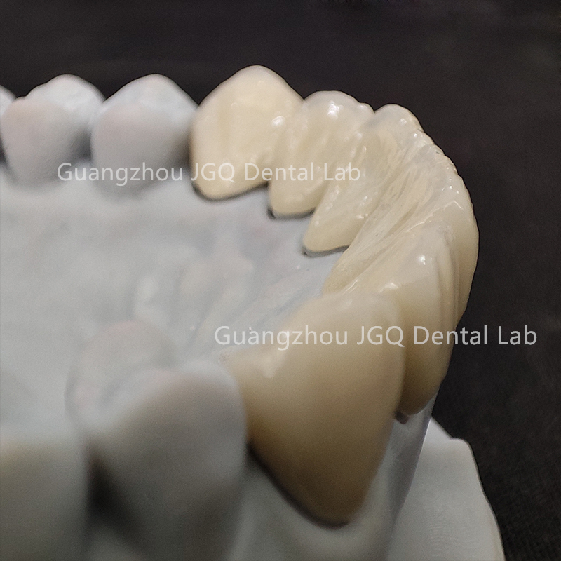 Outsourced Dental Lab Services Custom Zirconia Crown Bridge Anterior Posterior Restoration Best Price