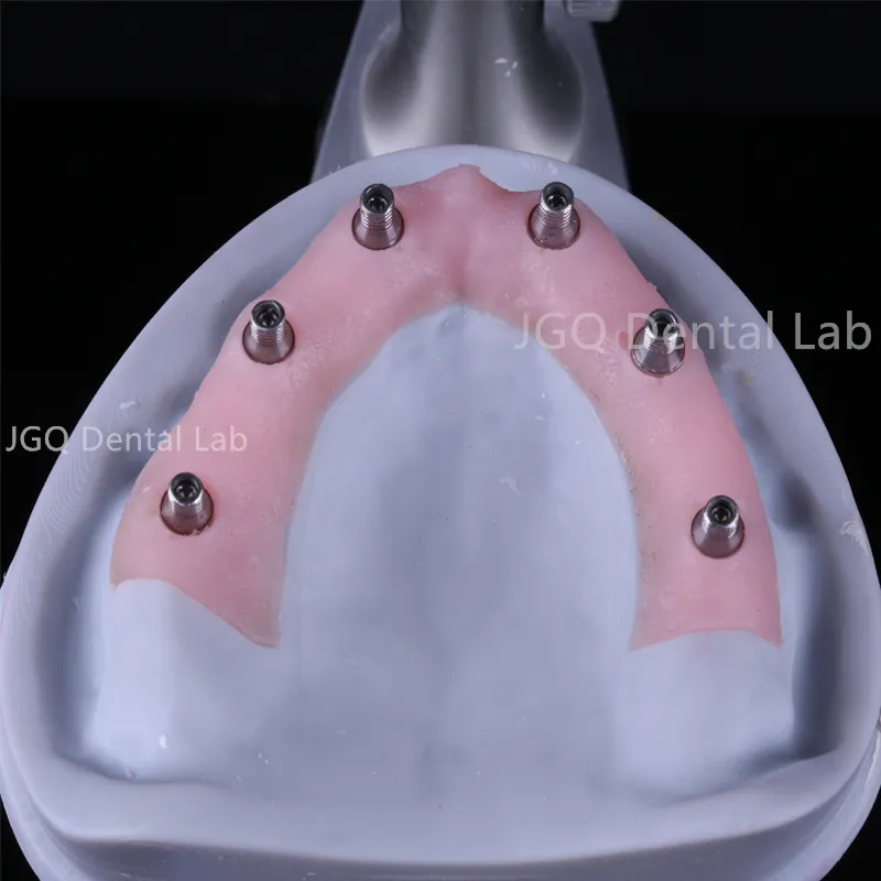 Titanium Abutments