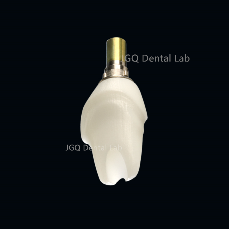 Good Price Affordable Dentures Multi-Unit Abutment Dental Implant System