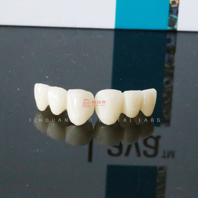 Dental Solid Zirconia Crowns Bridges Fixed Denture Restorations to Improve The Original Tooth