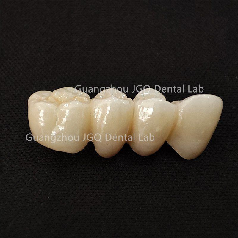 High Quality Perfect Perfect Aesthetic Zirconia Dentures Crown and Bridges with Cheap Price