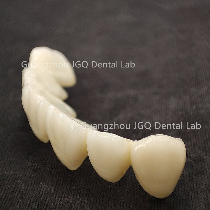 Outsourced Dental Lab Services Custom Zirconia Crown Bridge Anterior Posterior Restoration Best Price