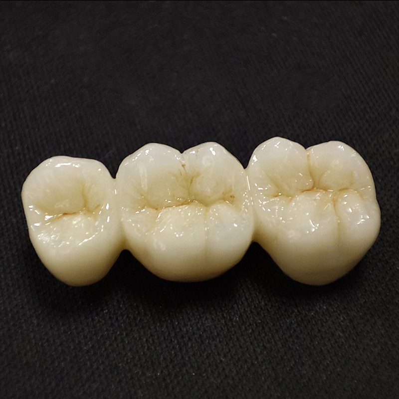 Digital Dental China Custom Full Solid Zirconia Bridge Crown Anterior Posterior Restoration Outsourcing Lab