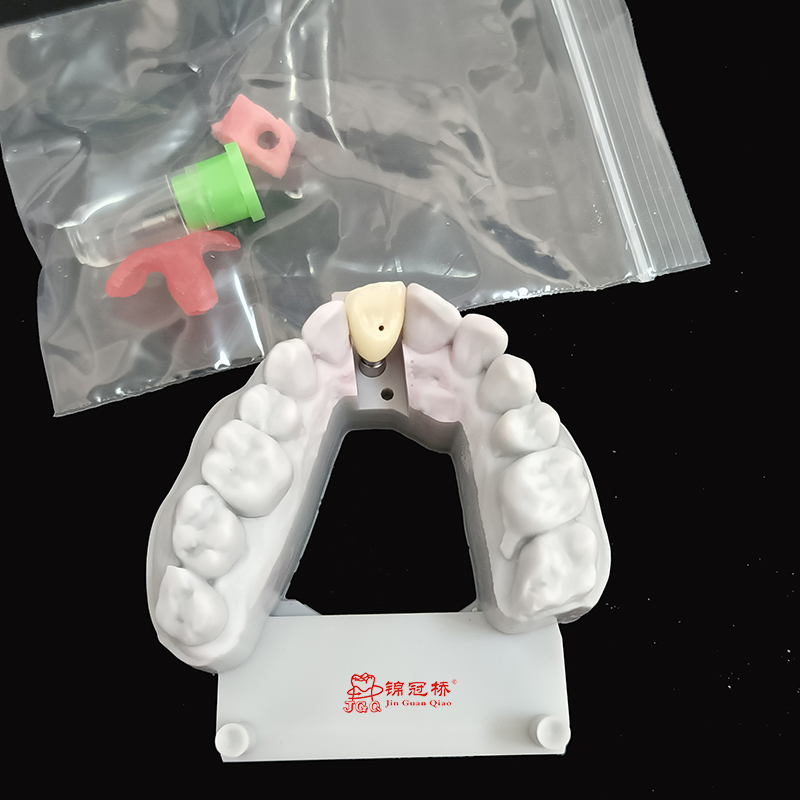 Zirconia Crowns Srewed Cement for Dental Implant with Aesthetic Restoration in Dentistry for Dentist China Dental Laboratory