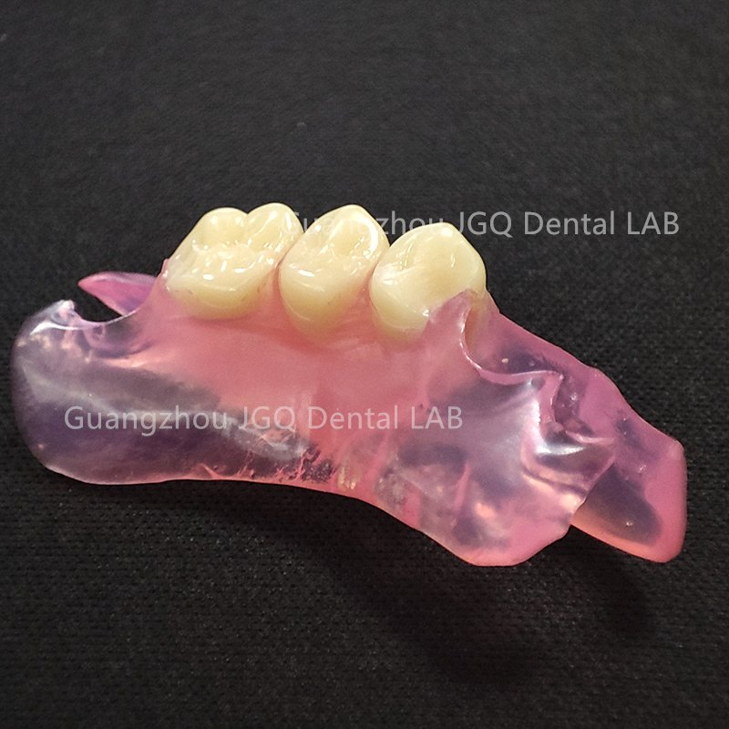 Custom Affordable Clear Pink Removable Partial Valplast Dentures with Flexible Base Acrylic Teeth