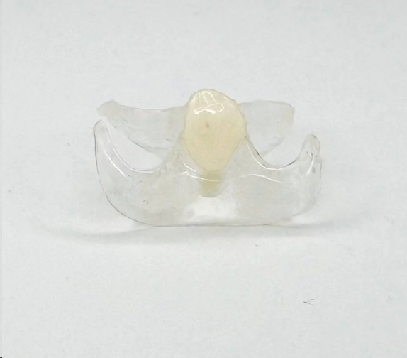 Custom Affordable Clear Pink Removable Partial Valplast Dentures with Flexible Base Acrylic Teeth