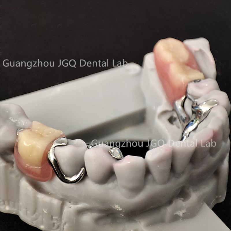 Removable Dentures Manufacturer Customize Partial Metal Frame with Acrylic Teeth Flexible