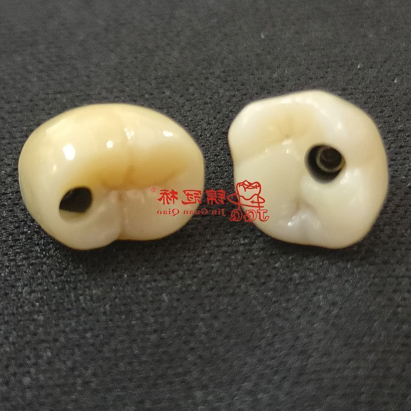 Zirconia Crowns Srewed Cement for Dental Implant with Aesthetic Restoration in Dentistry for Dentist China Dental Laboratory