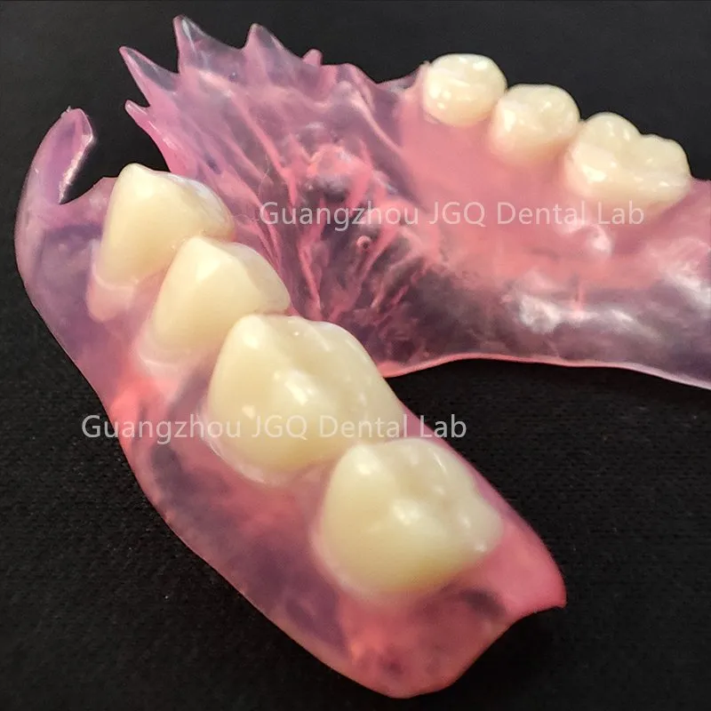 Valplast Dentures