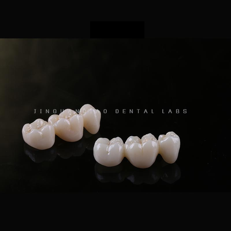 High Quality Perfect Perfect Aesthetic Zirconia Dentures Crown and Bridges with Cheap Price