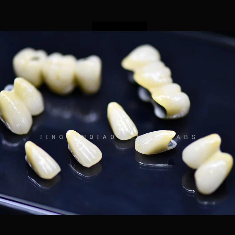 Pfm Single Crowns Short-Span Bridges Implant Supported Crown &amp; Bridge Perfect Fit