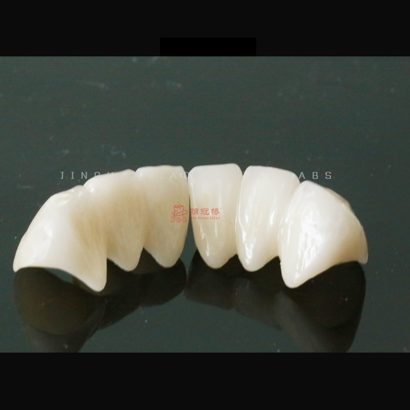 Dental Solid Zirconia Crowns Bridges Fixed Denture Restorations to Improve The Original Tooth