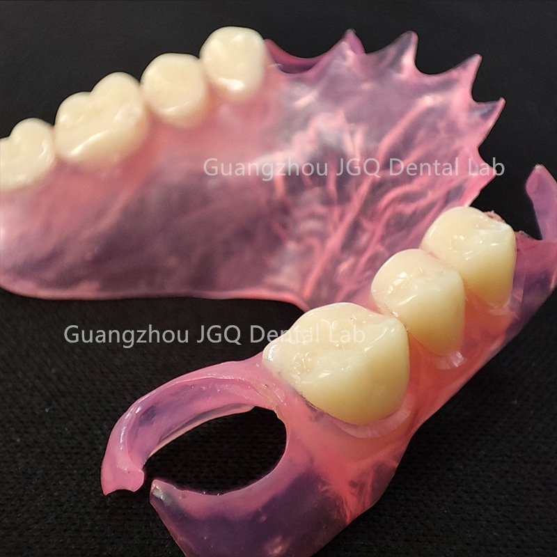 China Dental Lab Valplast Flexible Dentures