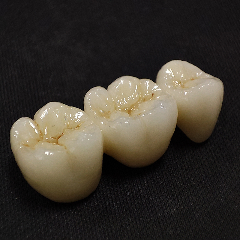 Digital Dental China Custom Full Solid Zirconia Bridge Crown Anterior Posterior Restoration Outsourcing Lab