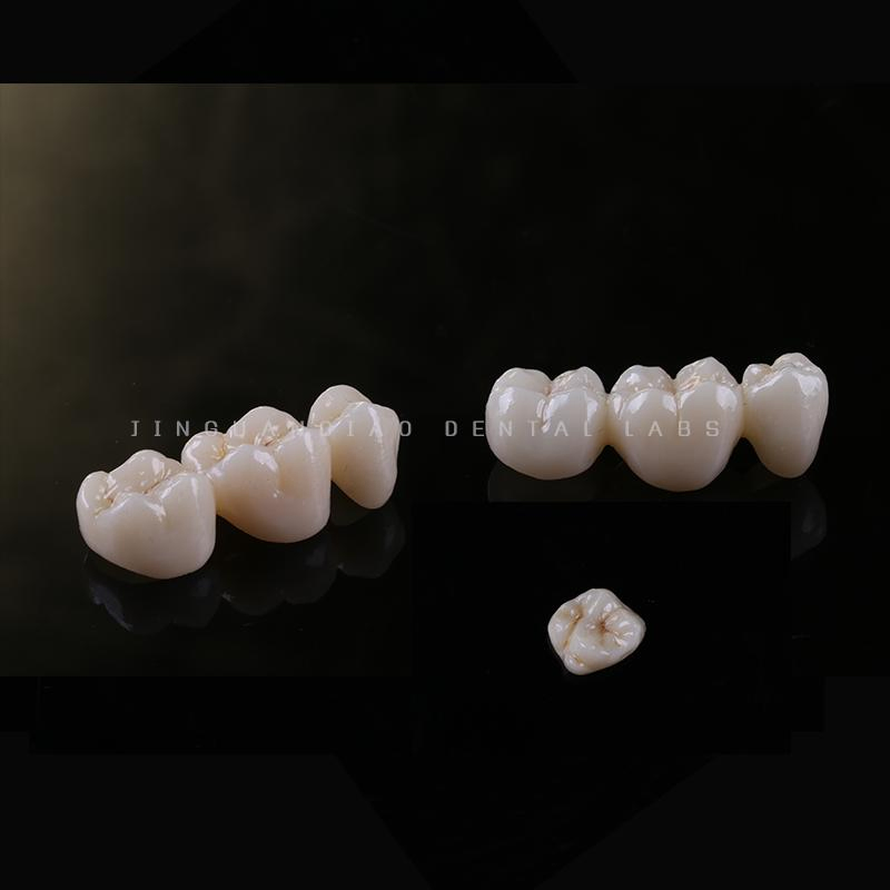 High Quality Perfect Perfect Aesthetic Zirconia Dentures Crown and Bridges with Cheap Price