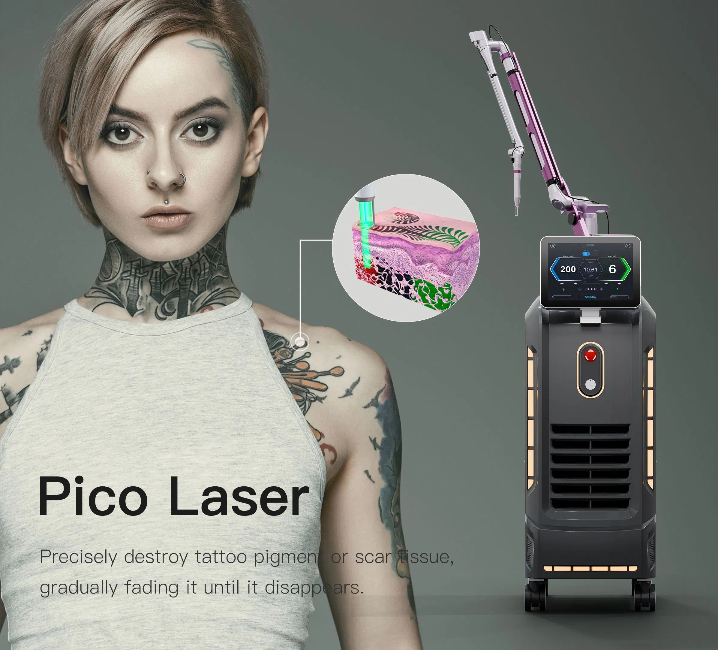 Powerful Tattoo Removal System Using Q-Switched ND YAG Laser