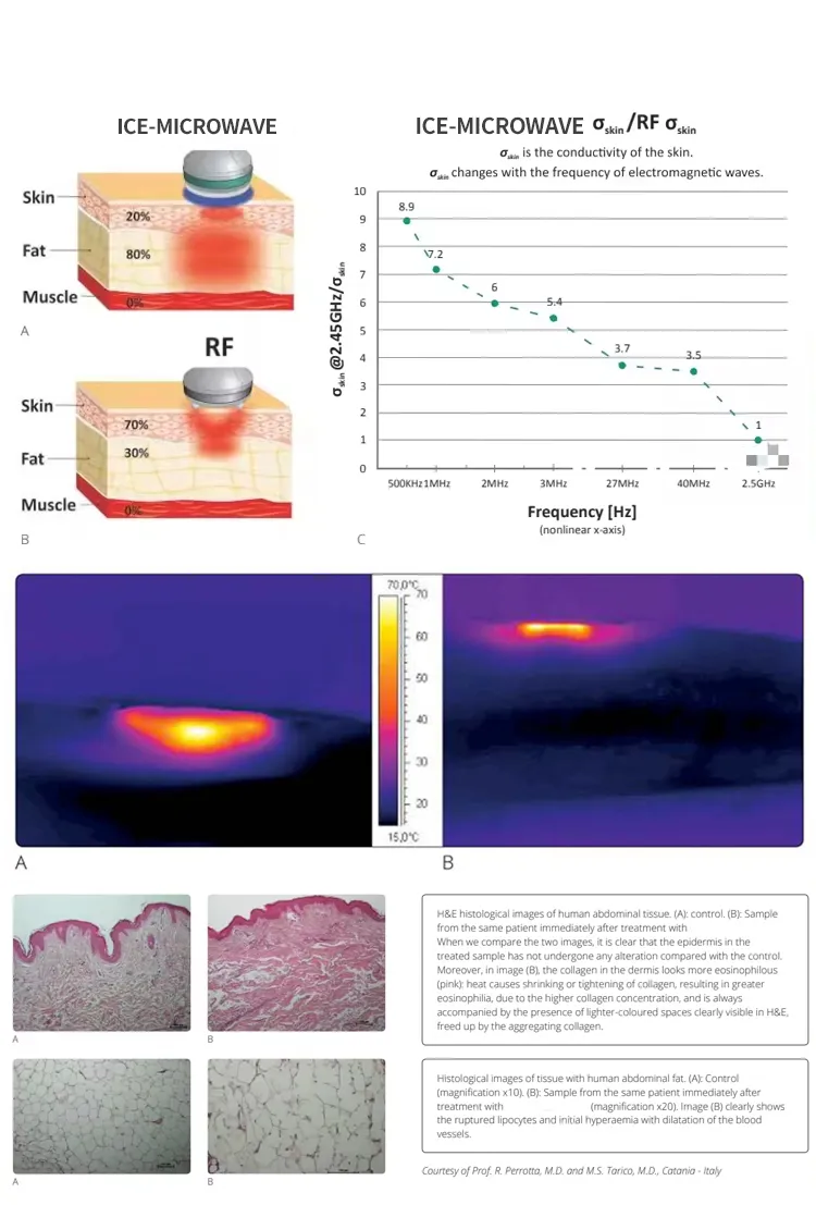 Weight Loss Technology