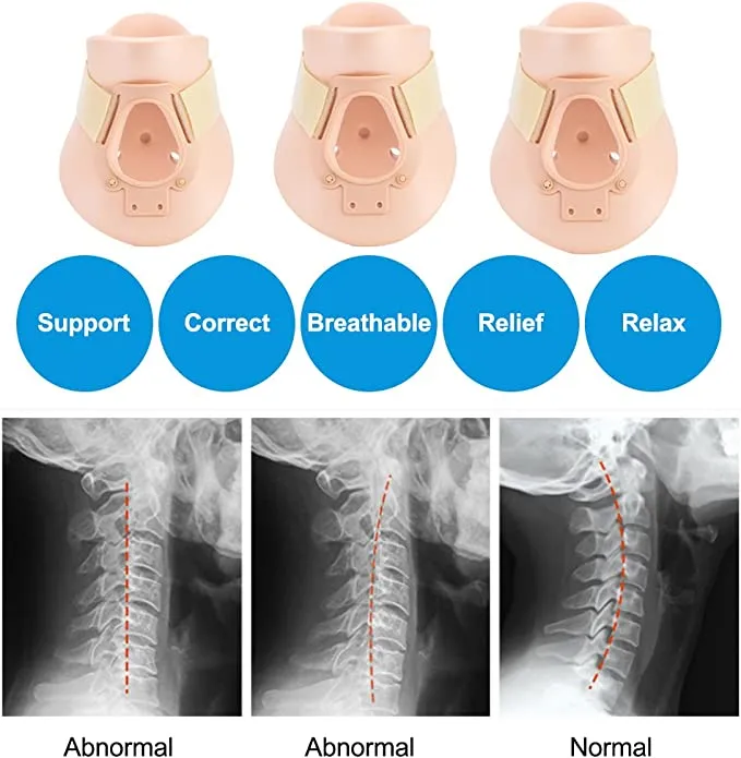 Philadelphia Neck Brace Front View