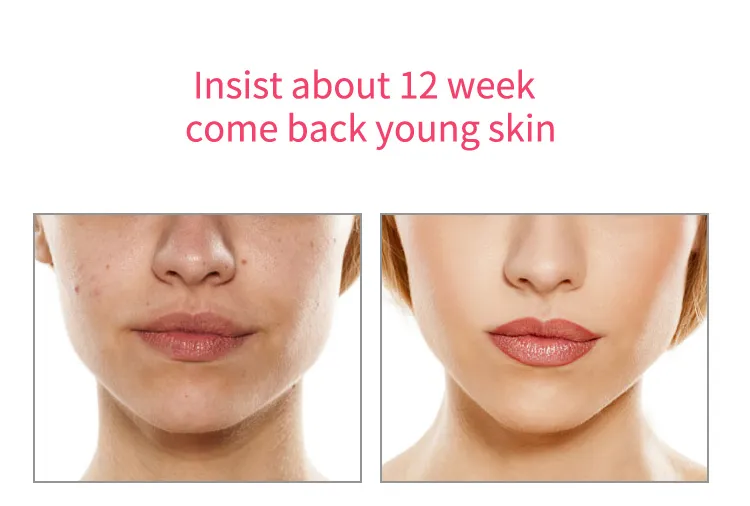 Skincare Tool Detail 7