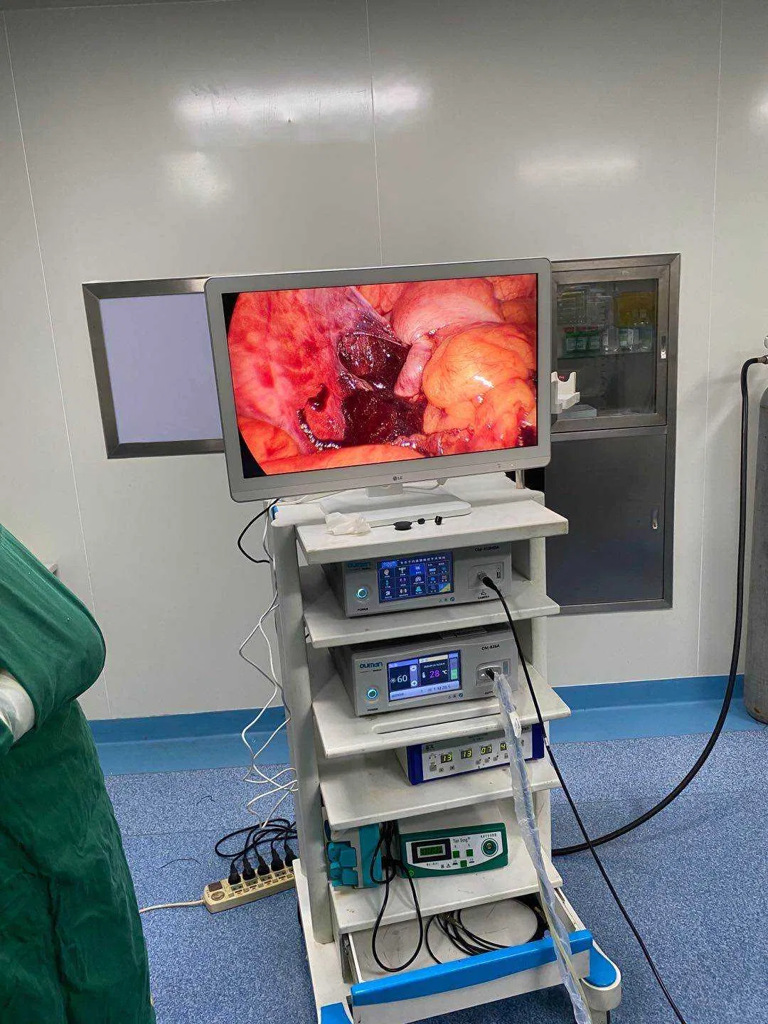 Ouman Large Metal Medical Trolley Cart for Arthroscopy Endoscopy System