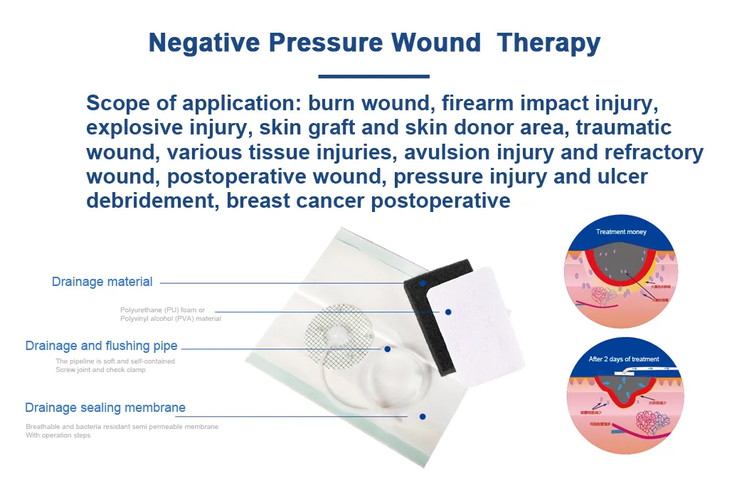 Wound Therapy Dressing Application