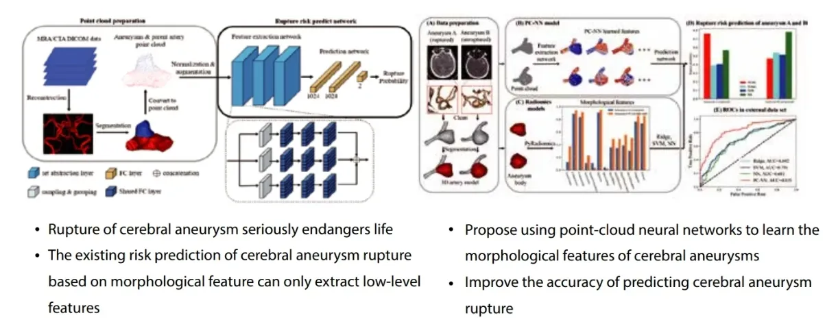 Aneurysm Prediction