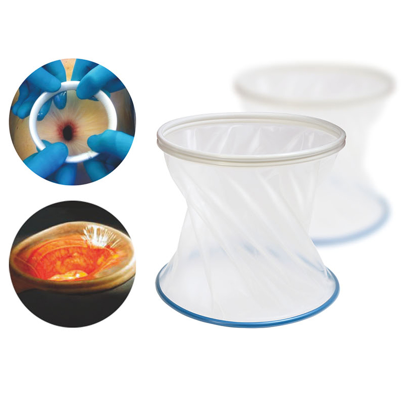 Disposable Medical Incision Protector Wound Retractor for Surgery Manual Power Source for Thoracic Surgery Eo Sterilized Class