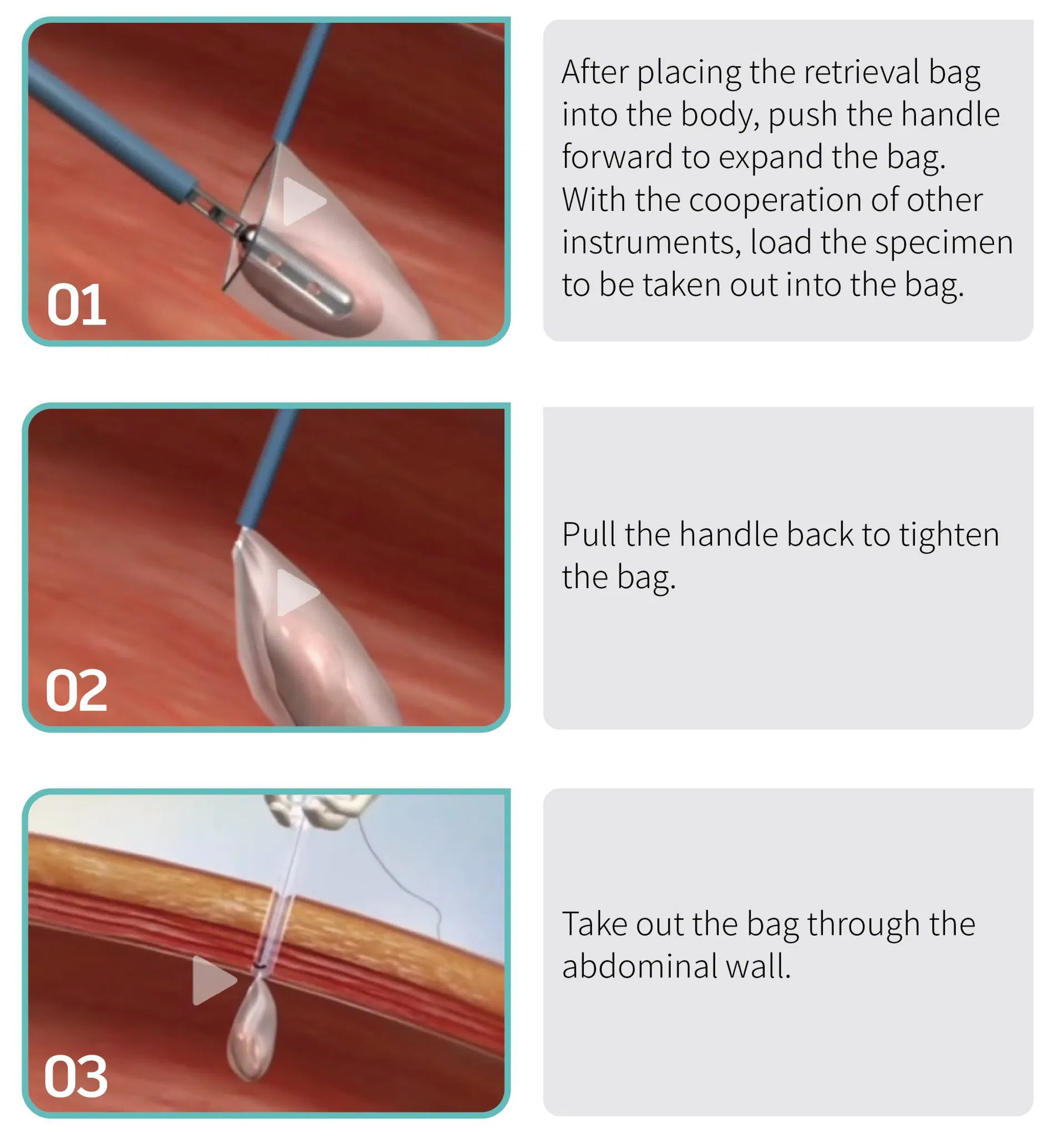 Specification Illustration 2