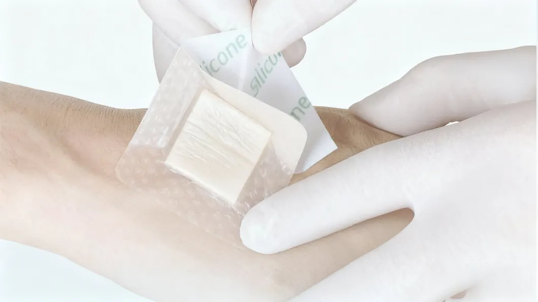 Silicone Foam Dressing Overview