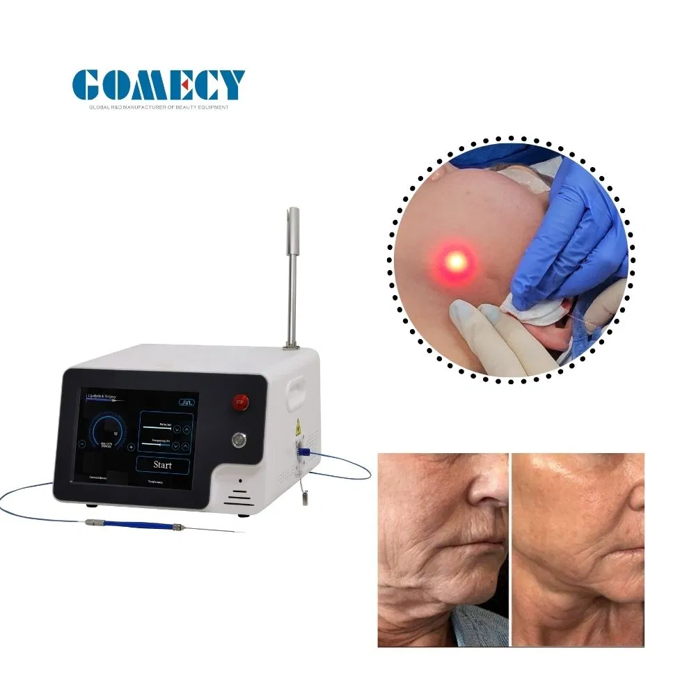 2025 Endolaser 980 1470nm Diode Facelifting Endolaser Body Firming Shaping Liposuction Machine